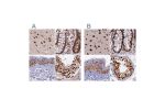 Immunohistochemical staining of human cerebral cortex, colon, skin and testis using Anti-FAM103A1 antibody HPA041923 (A) shows similar protein distribution across tissues to independent antibody HPA041948 (B).