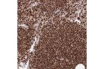 Immunohistochemical staining of human Lymph node shows strong nuclear positivity in germinal and non-germinal center cells.