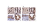 Immunohistochemical staining of human cerebral cortex, colon, skin and testis using Anti-FAM103A1 antibody HPA041948 (A) shows similar protein distribution across tissues to independent antibody HPA041923 (B).