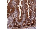 Immunohistochemical staining of human small intestine shows strong cytoplasmic positivity in glandular cells.