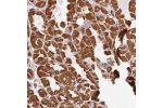 Immunohistochemical staining of human stomach, upper shows strong granular cytoplasmic positivity in glandular cells.