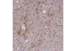 Immunohistochemical staining of human cerebral cortex shows weak positivity in neuropil.
