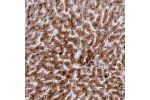 Immunohistochemical staining of human liver shows strong granular cytoplasmic positiviity in hepatocytes.