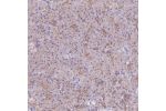 Immunohistochemical staining of human pancreas shows moderate membranous positivity in exocrine cells.