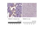 Immunohistochemistry analysis in human fallopian tube and liver tissues using HPA042081 antibody. Corresponding TMEM231 RNA-seq data are presented for the same tissues.
