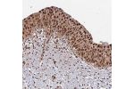 Immunohistochemical staining of human urinary bladder shows strong nuclear positivity in urothelial cells.