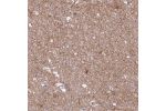 Immunohistochemical staining of human testis shows strong granular cytoplasmic positivity in subset of cells in seminiferus ducts.