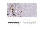 Immunohistochemistry analysis in human kidney and liver tissues using Anti-HSD11B2 antibody. Corresponding HSD11B2 RNA-seq data are presented for the same tissues.