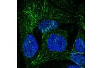 Immunofluorescent staining of human cell line CACO-2 shows localization to microtubules.