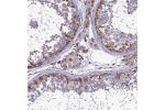 Immunohistochemical staining of human testis shows cytoplasmic positivity in basal cells.