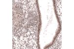 Immunohistochemical staining of human endometrium shows moderate nuclear positivity in glandular and stromal cells.