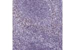 Immunohistochemical staining of human tonsil shows nuclear positivity in non-germinal center.