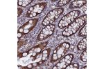 Immunohistochemical staining of human rectum shows strong cytoplasmic positivity in glandular cells.