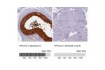Immunohistochemistry analysis in human epididymis and skeletal muscle tissues using HPA042302 antibody. Corresponding WFDC2 RNA-seq data are presented for the same tissues.