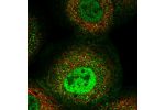 Immunofluorescent staining of human cell line A-431 shows localization to nucleoplasm, plasma membrane & cytosol.