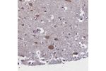 Immunohistochemical staining of human cerebral cortex shows moderate cytoplasmic positivity in neurons.