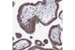 Immunohistochemical staining of human placenta shows moderate granular cytoplasmic positivity in trophoblastic cells.