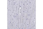 Immunohistochemical staining of human cerebral cortex shows positivity in neuropil.