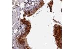 Immunohistochemical staining of human bronchus shows strong cytoplasmic positivity in respiratory epithelial cells with distinct extracellular material.
