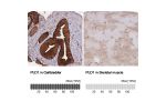 Immunohistochemistry analysis in human gallbladder and skeletal muscle tissues using Anti-PLD1 antibody. Corresponding PLD1 RNA-seq data are presented for the same tissues.