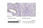 Immunohistochemistry analysis in human testis and kidney tissues using Anti-KIAA1683 antibody. Corresponding KIAA1683 RNA-seq data are presented for the same tissues.