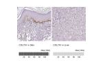 Immunohistochemistry analysis in human skin and liver tissues using HPA042420 antibody. Corresponding COL7A1 RNA-seq data are presented for the same tissues.