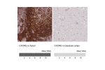Immunohistochemistry analysis in human tonsil and cerebral cortex tissues using HPA042432 antibody. Corresponding CXCR5 RNA-seq data are presented for the same tissues.