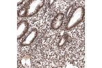 Immunohistochemical staining of human endometrium shows strong nuclear positivity in glandular and stromal cells.