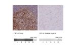 Immunohistochemistry analysis in human tonsil and skeletal muscle tissues using HPA042455 antibody. Corresponding CR1 RNA-seq data are presented for the same tissues.