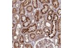 Immunohistochemical staining of human kidney shows strong cytoplasmic positivity in cells in tubules.