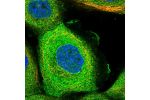 Immunofluorescent staining of human cell line A-431 shows localization to plasma membrane & cytosol.