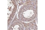 Immunohistochemical staining of human testis shows moderate cytoplasmic positivity in cells in seminiferus ducts and Leydig cells.