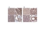 Immunohistochemical staining of human cerebral cortex, gastrointestinal, pancreas and testis using Anti-CTB-50L17.10 antibody HPA042559 (A) shows similar protein distribution across tissues to independent antibody HPA044208 (B).