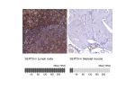 Immunohistochemistry analysis in human lymph node and skeletal muscle tissues using HPA042564 antibody. Corresponding SEPT9 RNA-seq data are presented for the same tissues.