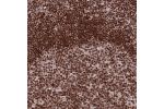 Immunohistochemical staining of human vulva/anal skin shows strong nuclear positivity in epidermal cells.