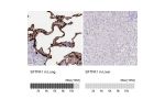 Immunohistochemistry analysis in human lung and liver tissues using HPA042638 antibody. Corresponding SFTPA1 RNA-seq data are presented for the same tissues.