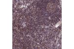 Immunohistochemical staining of human lymph node shows strong nuclear positivity in non-germinal center cells.