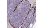 Immunohistochemical staining of human lymph node shows moderate membranous positivity in endothelial cells.