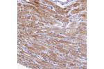 Immunohistochemical staining of human heart muscle shows strong cytoplasm granular positivity in cardiomyocytes.