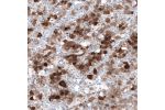 Immunohistochemical staining of human pituitary gland shows moderate to strong cytoplasmic positivity in endocrine glandular cells.