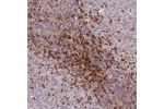 Immunohistochemical staining of human tonsil shows strong cytoplasmic positivity in non-germinal center cells.