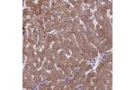 Immunohistochemical staining of human liver shows moderate cytoplasmic positivity in hepatocytes.