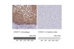 Immunohistochemistry analysis in human esophagus and cerebral cortex tissues using Anti-S100A11 antibody. Corresponding S100A11 RNA-seq data are presented for the same tissues.