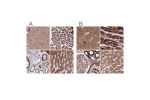 Immunohistochemical staining of human cerebral cortex, heart muscle, kidney and liver using Anti-ATP5H antibody HPA042777 (A) shows similar protein distribution across tissues to independent antibody HPA048459 (B).