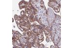 Immunohistochemical staining of human colon shows strong cytoplasmic positivity in glandular cells.