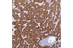 Immunohistochemical staining of human liver shows strong cytoplasmic positivity in hepatocytes.