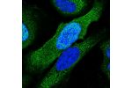 Immunofluorescent staining of human cell line U-2 OS shows localization to nucleoplasm & cytosol.