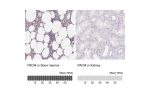 Immunohistochemistry analysis in human bone marrow and kidney tissues using Anti-PADI4 antibody. Corresponding PADI4 RNA-seq data are presented for the same tissues.