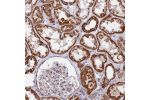 Immunohistochemical staining of human kidney shows strong cytoplasmic positivity in cells in tubules.