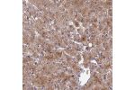 Immunohistochemical staining of human liver shows moderate cytoplasmic positivity in hepatocytes.
